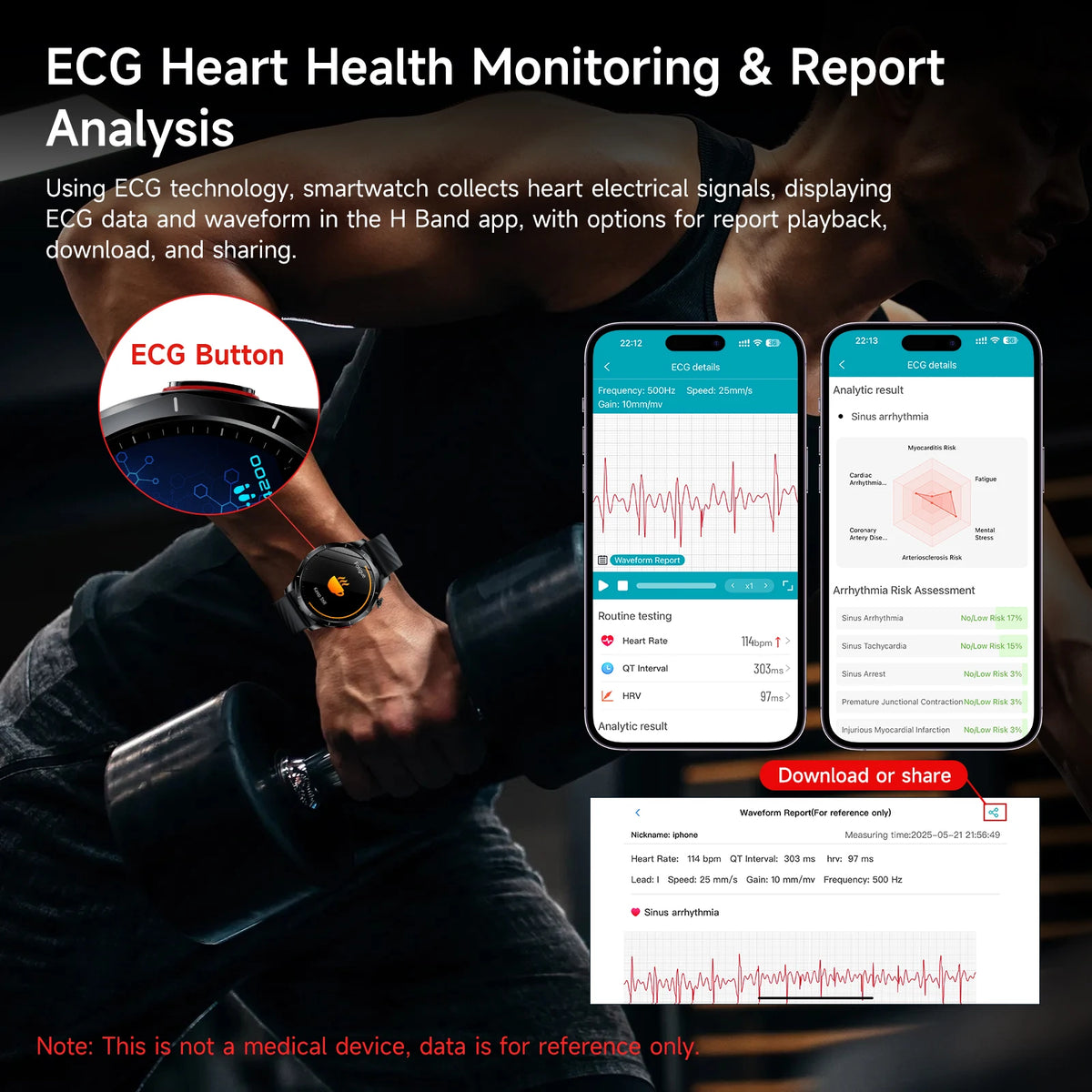Marsyu ECG+PPG Health Diagnosis Smart watch Men Women sapphire Clock Uric Acid Lipid BP Heart rate Tracker Sports Smart Watch